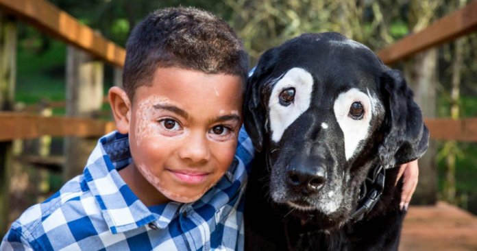 Criança com vitiligo supera depressão ao encontrar um filhote com a mesma condição