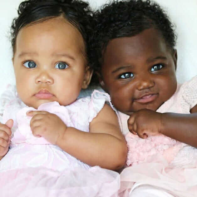 asomadetodosafetos.com - Gêmeas com tons de pele diferentes mostram que a diversidade é linda