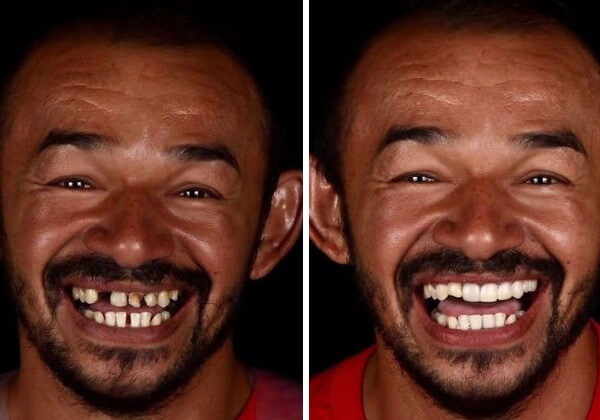 asomadetodosafetos.com - Dentista brasileiro conserta dentes de graça no país e no exterior