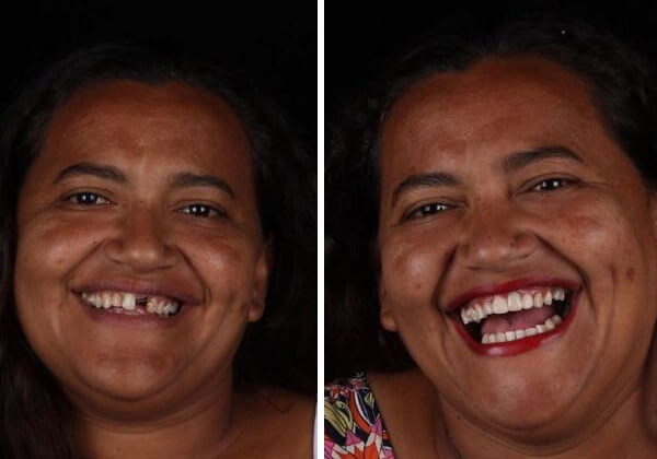 asomadetodosafetos.com - Dentista brasileiro conserta dentes de graça no país e no exterior