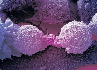 Cientistas descobrem uma célula imune que pode ser a chave para o tratamento do câncer