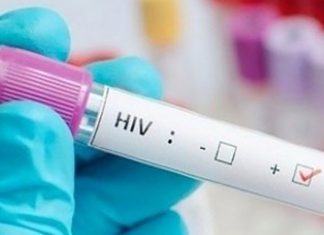 Duas cientistas descobrem como eliminar o vírus HIV das células dos portadores