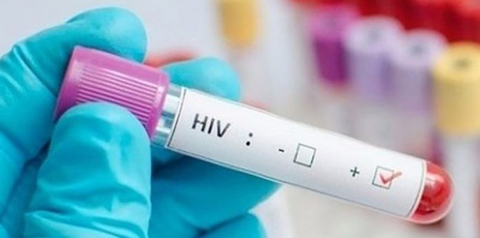 Duas cientistas descobrem como eliminar o vírus HIV das células dos portadores