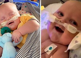 Bebê sorri pela primeira vez após 2 operações no coração. Seu sorriso é uma luz de esperança