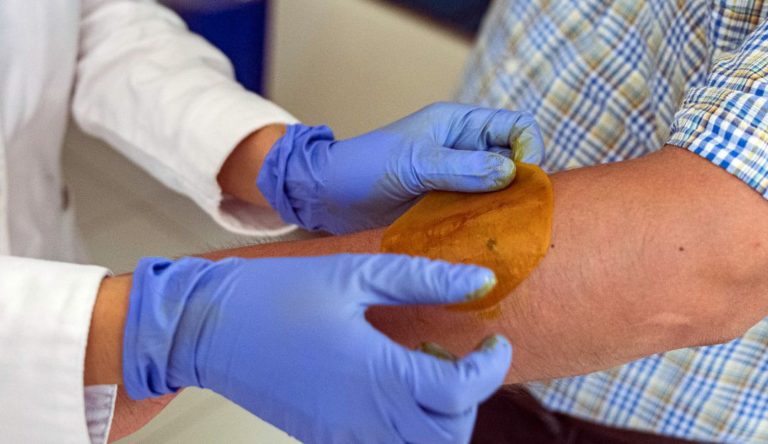 asomadetodosafetos.com - Cientistas criam adesivo capaz de regenerar a pele de diabéticos em 21 dias
