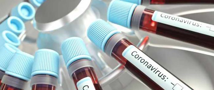 Primeiro paciente com Coronavírus no Brasil está oficialmente curado