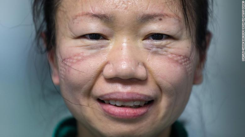 asomadetodosafetos.com - Estes são os rostos dos médicos que combatem o coronavírus pelo mundo