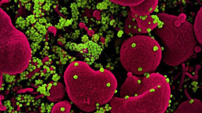 Cientistas descobrem que medicamento usado para combater linfoma bloqueia Covid