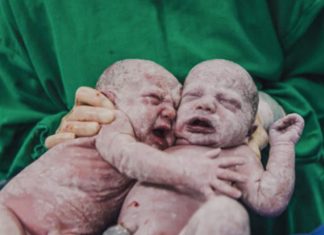 Imagem de gêmeas se abraçando logo após o parto viraliza e emociona web