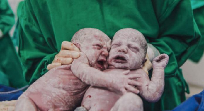 Imagem de gêmeas se abraçando logo após o parto viraliza e emociona web