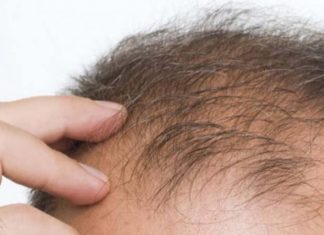 Japoneses regeneram cabelos com células-tronco e pode ter resolvido o problema da calvície