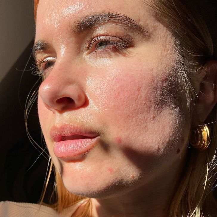 asomadetodosafetos.com - Influencer se recusa a usar filtros e exibe seu bigode para derrubar os padrões de beleza