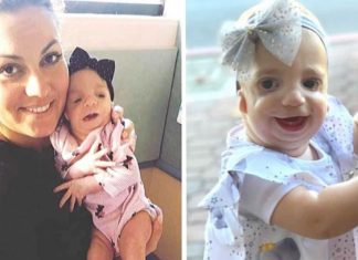 Mãe de bebê com síndrome rara faz desabafo: “Ninguém me deu os parabéns pela chegada da minha filha”