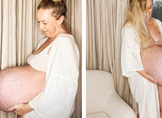 Blogueira grávida de trigêmeos chama a atenção da web com barriga; saiba o que é