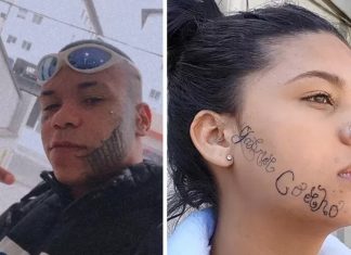 Jovem com rosto tatuado à força pelo ex recebe ajuda para remover tatuagem