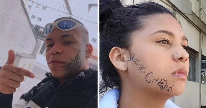 Jovem com rosto tatuado à força pelo ex recebe ajuda para remover tatuagem