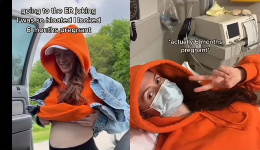 asomadetodosafetos.com - Mulher vai ao médico com constipação e descobre gravidez de seis meses