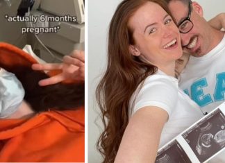 Mulher vai ao médico com constipação e descobre gravidez de seis meses