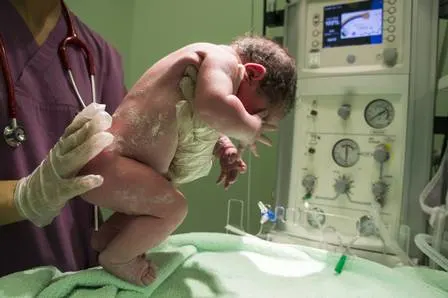 asomadetodosafetos.com - Mulher que está há sete meses em coma dá à luz a bebê saudável: "Altamente incomum"