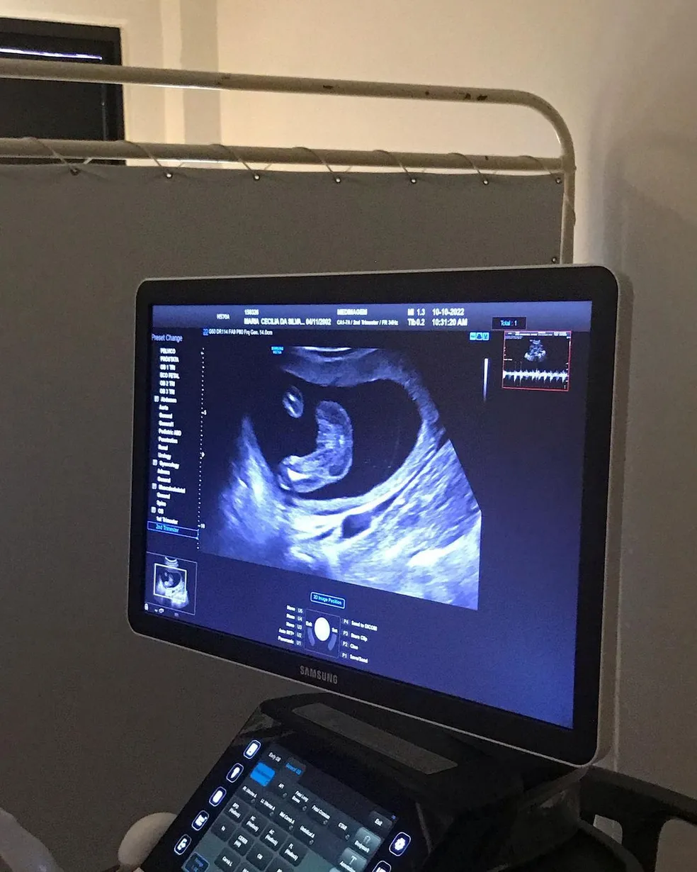 asomadetodosafetos.com - No sétimo mês de gravidez, mãe descobre que dará luz a gêmeos: "Achei que era um só"