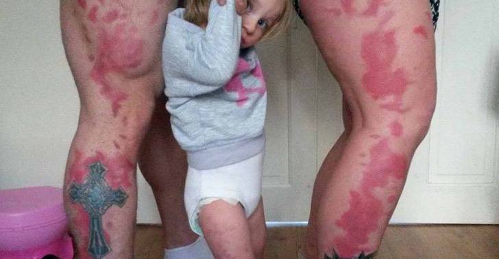 asomadetodosafetos.com - Pais homenageiam filha com tatuagem idêntica à sua marca de nascença: "Doloroso, mas valeu a pena"