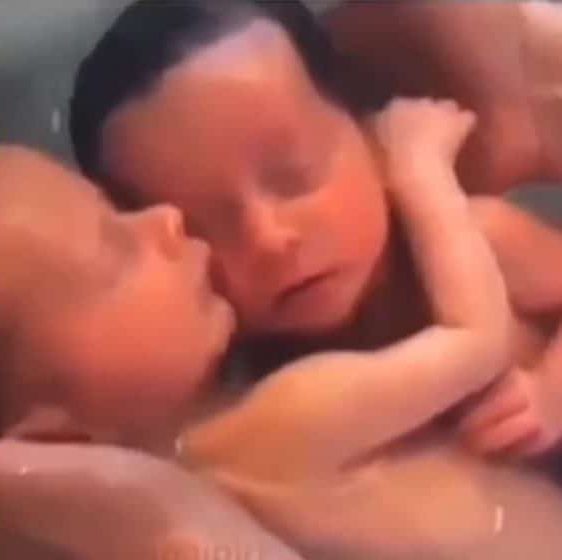 asomadetodosafetos.com - Vídeo emocionante mostra gêmeos abraçados que não percebem seu nascimento